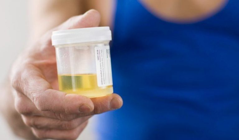 How to beat a urine drug test without using a synthetic urine kit?